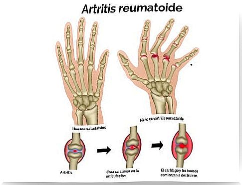 Arthritis relief is in nature