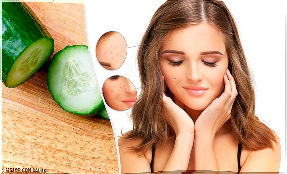 Homemade tonics to control oily skin