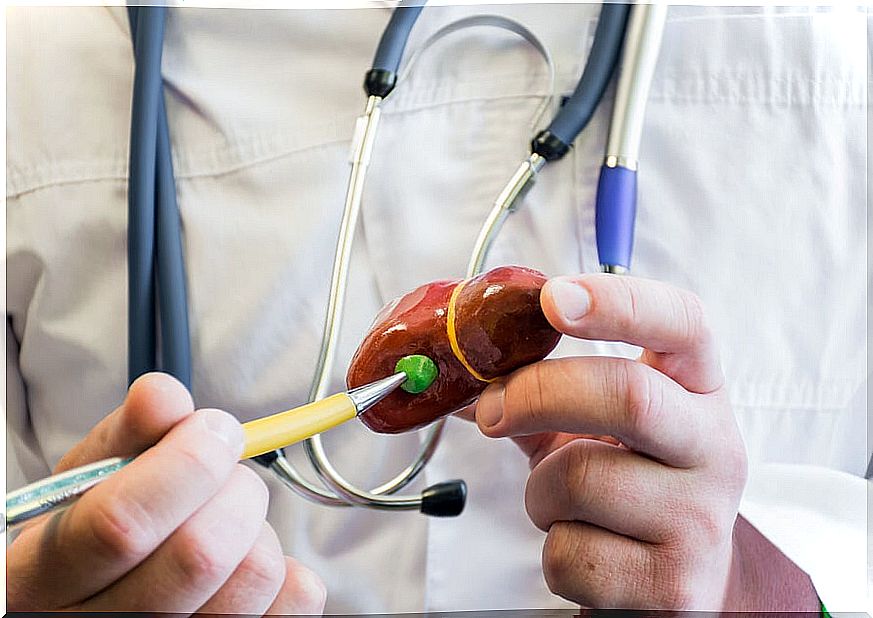 Doctor holding gallbladder to explain gallstones