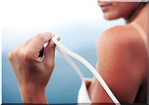 Natural remedies to treat sunburn