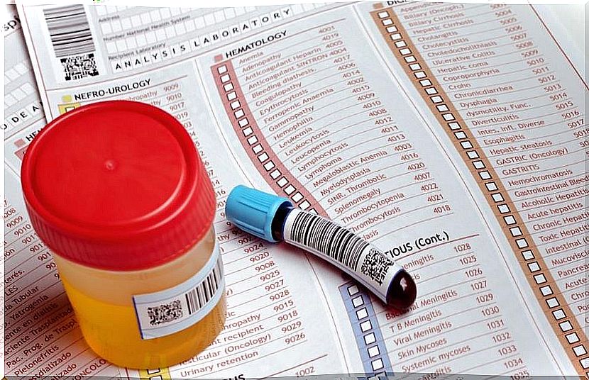 blood-in-urine-nephritis