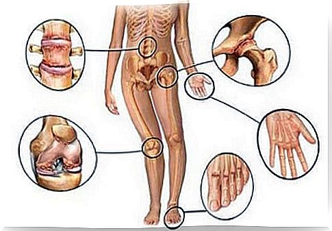 Joint pain areas