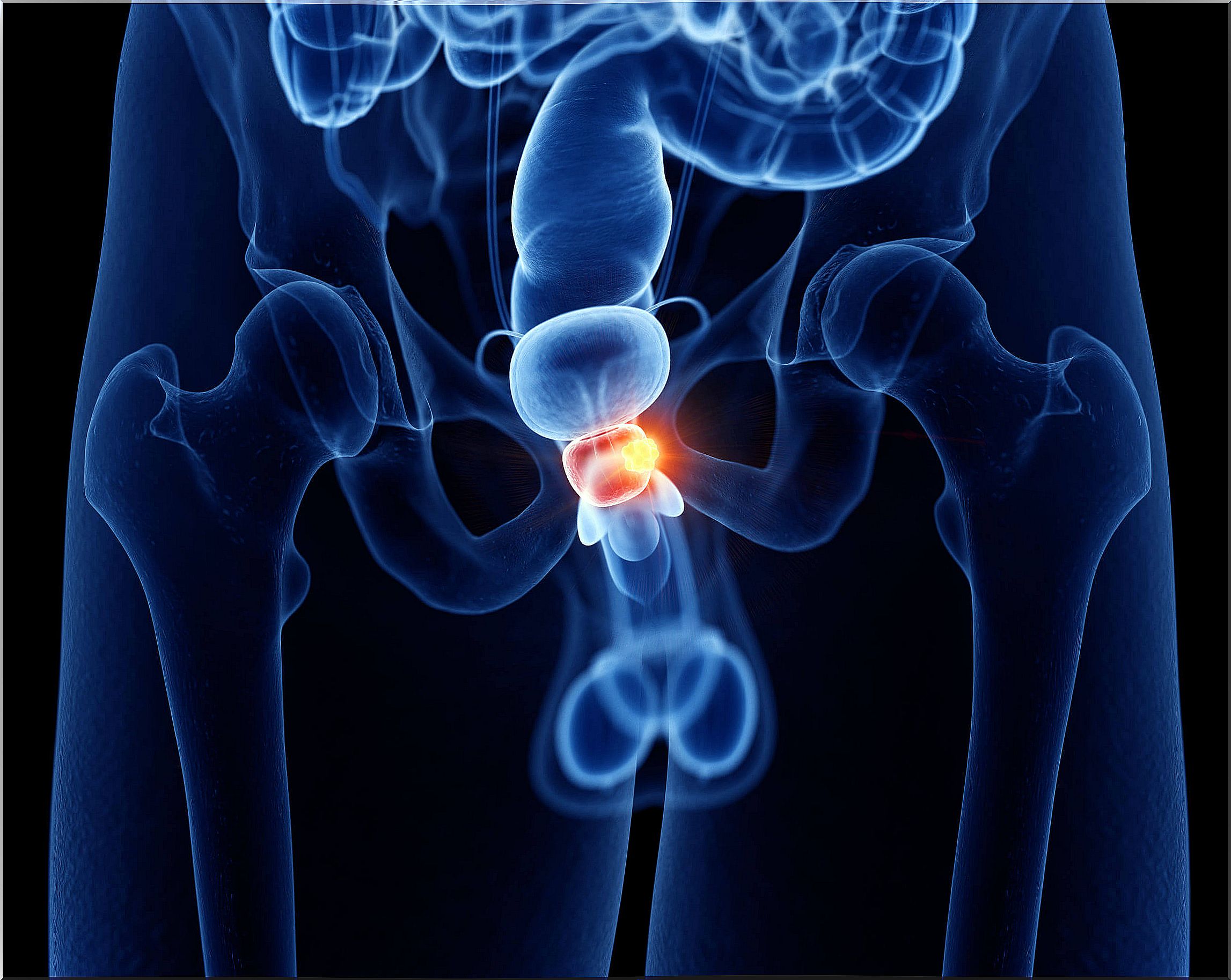 Urinary incontinence can be due to prostate problems.